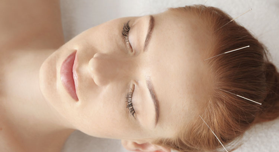 1st Session @ $68 - Pulse TCM Acupuncture Hair Loss + Consultation | Doctor  Anywhere Marketplace